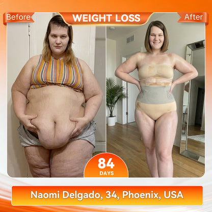 𝐏𝐚𝐢𝐝𝐮𝐢𝐬® 🔥𝐌𝐨𝐫𝐢𝐧𝐠𝐚 & 𝐁𝐞𝐫𝐛𝐞𝐫𝐢𝐧𝐞 4‑In‑1 Micro‑Particle Sculpting & Fat‑Burn Shorts