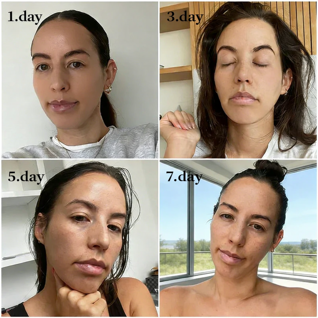 💖Online Pharmacy |Purelora® EGF & Copper Peptide Revitalizing Essence Cream (Deeply activates skin renewal, helping visibly firm, smooth, and rejuvenate the skin)